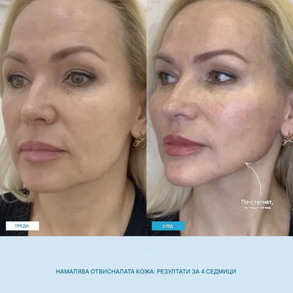 LiftSkin™ масажор за лице + Безплатен серум