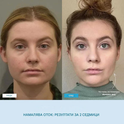 LiftSkin™ масажор за лице + Безплатен серум